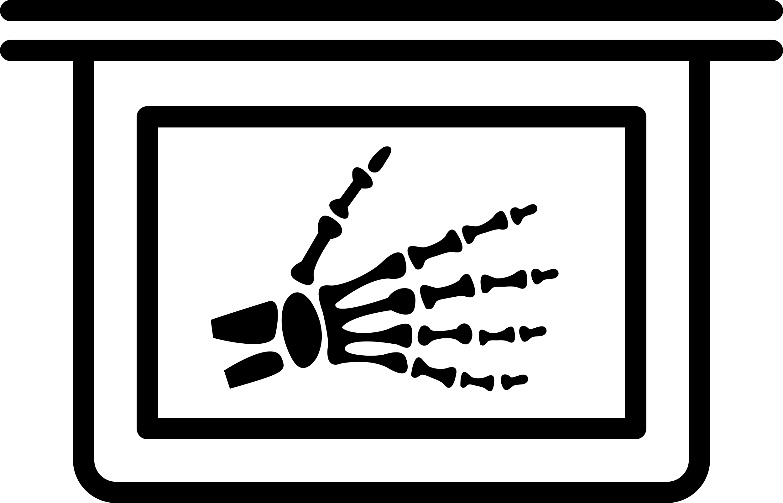 Hand Bones In X Ray Plate Silhouette Cutting Svg Files Free Vectors